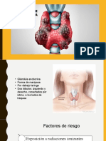 Tumores malignos de la tiroides