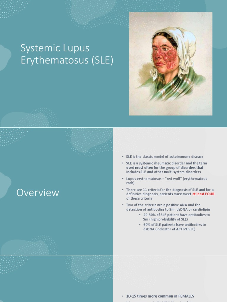 Systemic Lupus Erythematosus Overview | PDF | Medical Specialties ...