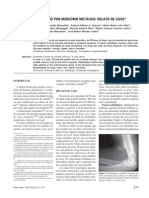 Embolismo Por Mercúrio Metálico: Relato de Caso