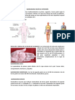 Quemaduras Según Su Extensión