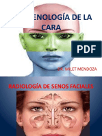 Imágenología senos faciales