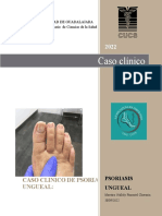 Caso Clinico de Psoriasis Ungueal