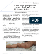 Giant Tumor of The Thigh Type Epithelioid Sarcoma of The Soft Tissues A Rare Case With Literature Review