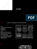 CNS