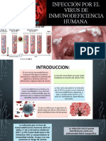 Infección Por El Virus de Inmunodeficiencia Humana