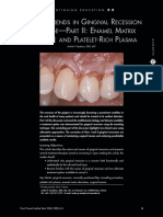 Current Trends in Gingival Recession Cov