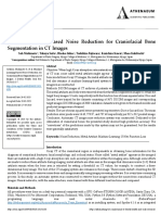 Machine Learning Based Noise Reduction For Craniofacial Bone Segmentation in CT Images