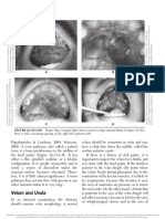 (Team 6) Cleft Palate Craniofacial Anomalies - Effects On Speech and Resonance