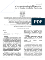 Determining The Immunohistochemical Expression of P53 and Its Role in Grading Urothelial Carcinoma