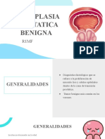 Hiperplasia Prostática Benigna