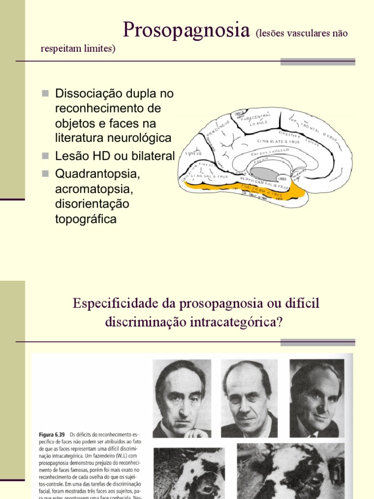 Entendendo a Prosopagnosia e suas Síndromes | PDF | Neurociência ...