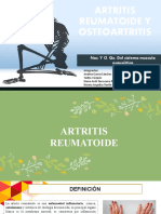 Artritis Reumatoide y Osteoartritis