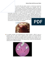 Caso clinico  patologia bucal Papiloma