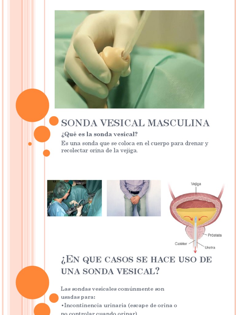 Uso y colocación de sonda vesical masculina | PDF | Vejiga urinaria ...
