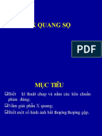 X quang nao cot song đã chuyển đổi