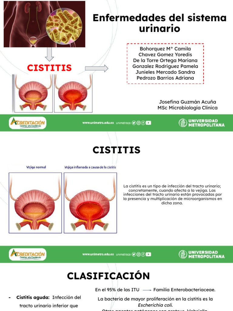 Cistitis en mujeres: diagnóstico y tratamiento | PDF | Infección del ...