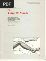 Download 11 Tibia  Fibulaa by idarama SN63426826 doc pdf