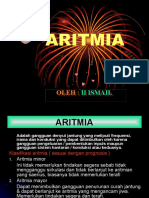 Aritmia 1 118