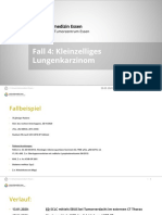 Fall 4: Kleinzelliges Lungenkarzinom: 30.09.2020 Dr. Med. Gregor Zaun