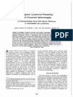 Cancer - 1 May 1985 - Narang - Malignant Lymphoma Presenting With Prominent Splenomegaly A Clinicopathologic Study With