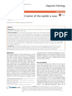 Apocrine Mixed Tumor