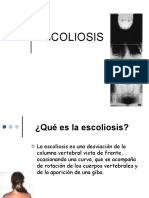 ESCOLIOSIS