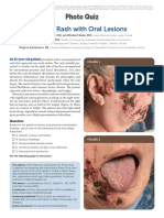 Facial Rash With Oral Lesions