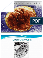 Toxoplasmosis