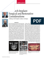 Full-Arch Implant Surgical and Restorative Considerations: Implants