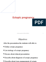 Ectopic Pregnancy by MARKOS MAKISHA