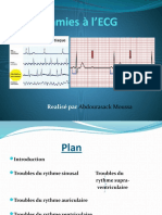 Diagnostic Des Arythmies
