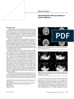 Encefa Fetal