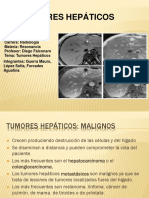 Tumores Hepáticos PPW