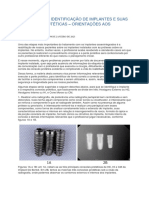 Etapas para A Identificação de Implantes e Suas Conexões Protéticas