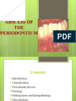 Abscess of THE Periodontium