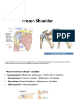 Frozen Shoulder: By: Kanchan Sharma