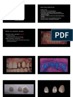 Ceramic Veneers DR Jason Wang