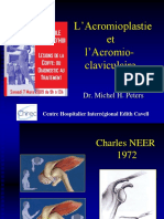 L'Acromioplastie Et L'acromio-Claviculaire: Dr. Michel H. Peters
