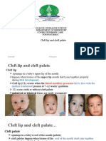 Cleft Lip and Cleft Palate: College of Health Science Department of Midwifery Course Newborn Care For Postbasic