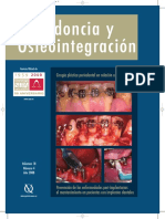 Periodoncia y Osteointegración: Cirugía Plástica Periodontal en Relación A La