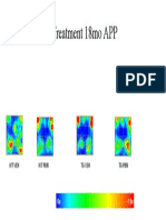 NOR Post Treatment 18mo APP: WT Veh TG Veh TG PBN WT PBN