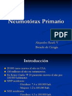 30 - Neumotorax Primario, U Chile