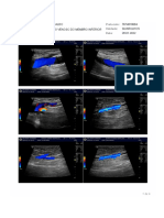 Doppler venoso membro inferior direito relatório