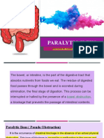 Paralytic Ileus: Prepared By: Laurence A. Adena, Man