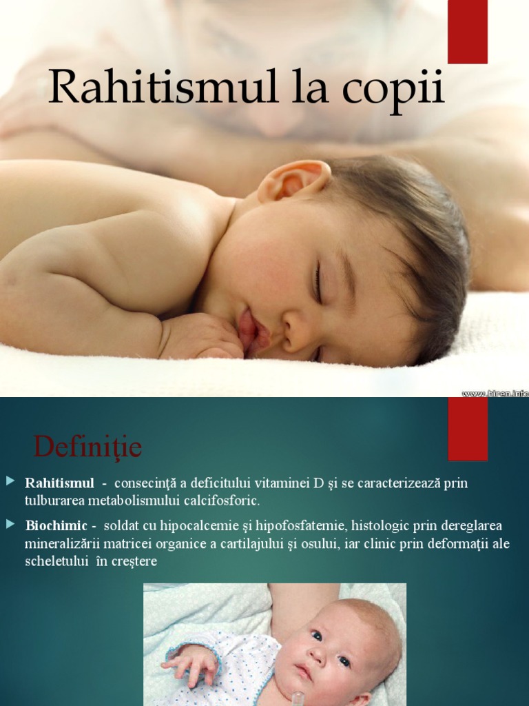 Rahitismul La Copii | PDF