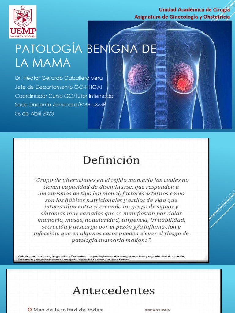 Patología Benigna de Mama- | PDF