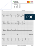 FC 127 LPM: I aVR V1 V4