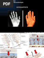 6831812-Aula12-Osteoartrite