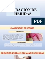 Curación de Heridas