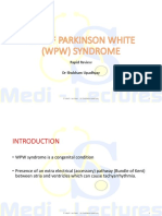 WPW Syndrome